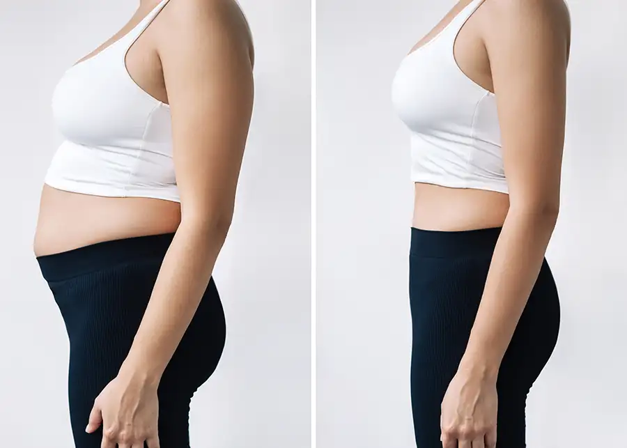 Vitalogie Medical - Medical Weight Loss, before and after - Chino, CA